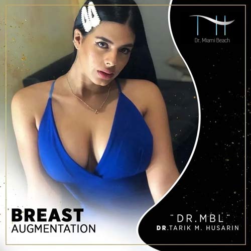 Breast Augmentation Gallery at Advanced Aesthetic Wellness in Miami Beach, FL