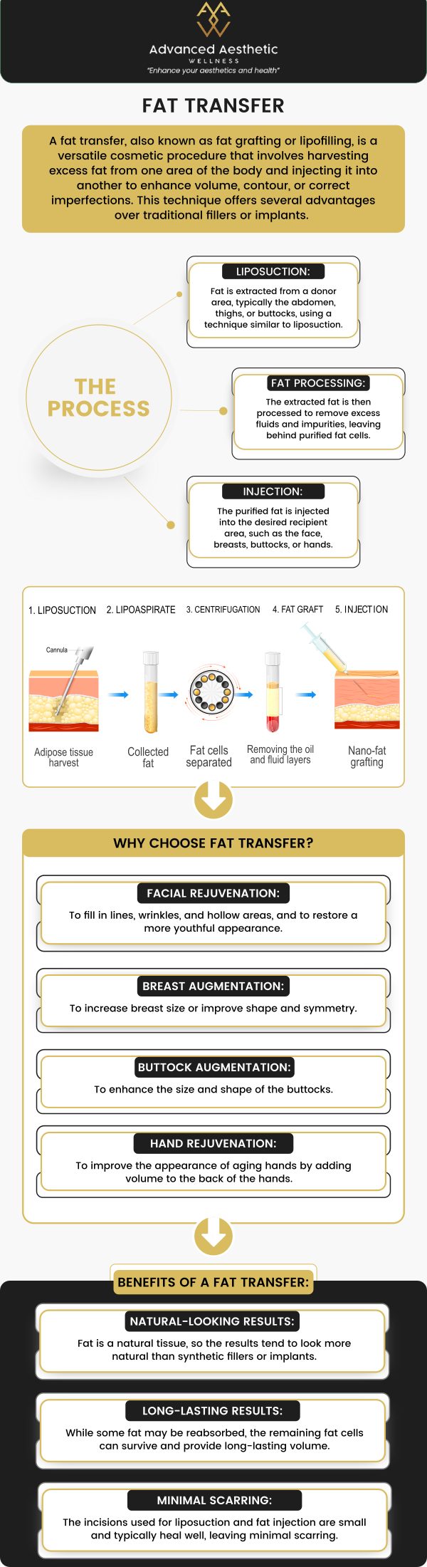 Common questions asked by clients: What is buttock augmentation with fat transfer, and how does it work? What are the benefits of choosing fat transfer for buttock enhancement? How long do the results of buttock augmentation with fat transfer last? Is fat transfer for buttock augmentation safe, and what are the risks? For more information, please contact us or schedule an appointment online. We are conveniently located at 400 W. 41St Street, Suite #412, Miami Beach, FL 33140. We serve clients from Miami Beach FL, Miami FL, Brickell FL, Bay Harbor Islands FL, Coral Gables FL, Sunny Isles FL, Key Biscayne FL, and surrounding areas. Common questions asked by clients: What is buttock augmentation with fat transfer, and how does it work? What are the benefits of choosing fat transfer for buttock enhancement? How long do the results of buttock augmentation with fat transfer last? Is fat transfer for buttock augmentation safe, and what are the risks? For more information, please contact us or schedule an appointment online. We are conveniently located at 400 W. 41St Street, Suite #412, Miami Beach, FL 33140. We serve clients from Miami Beach FL, Miami FL, Brickell FL, Bay Harbor Islands FL, Coral Gables FL, Sunny Isles FL, Key Biscayne FL, and surrounding areas.