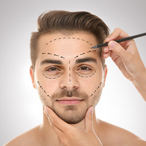 Male Facelift Near Me in Miami Beach, FL