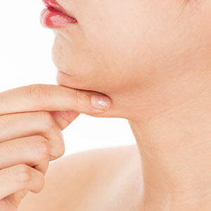 Neck Liposuction Near Me in Miami Beach, FL